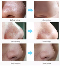 Load image into Gallery viewer, AMEIZII Mask (Skin Care)