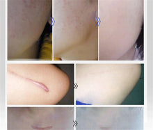 Load image into Gallery viewer, SCAR REMOVAL OIL