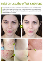 Load image into Gallery viewer, TEA TREE CREAM FOR ACNE