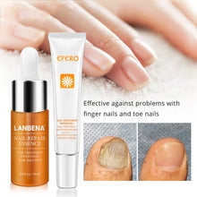 Load image into Gallery viewer, NAIL TREATMENT