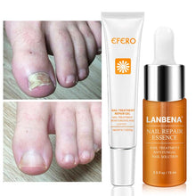 Load image into Gallery viewer, NAIL TREATMENT