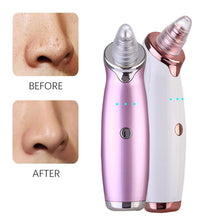 Load image into Gallery viewer, Blackhead Remover Face (Skin Care)
