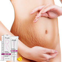 Load image into Gallery viewer, Stretch Mark Removal Cream