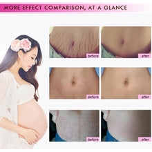 Load image into Gallery viewer, Stretch Mark Removal Cream