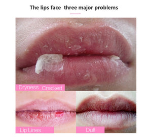 Lip  Mask