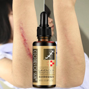 SCAR REMOVAL OIL