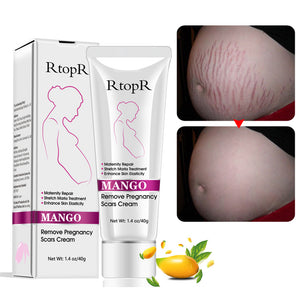 Stretch Mark Removal Cream