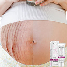 Load image into Gallery viewer, Stretch Mark Removal Cream
